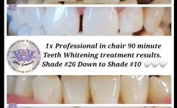 Lotus Embrace Beauty & Smile Studio - Richmond Teeth Whitening & Beauty Treatments