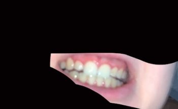 City Teeth Whitening