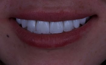 Nagem Dental Diet & Laser Center- Al Barsha