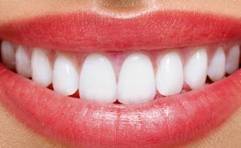 Al Najma Dental Clinic