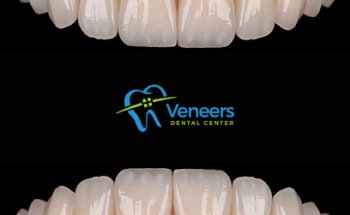 Veneers Dental Centre
