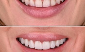 MyoSmile Polyclinic - Dental Clinic in Jumeirah