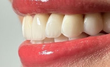 City Alpha Dental Care