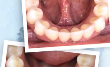 Proalign Smile Shop Dental Clinic