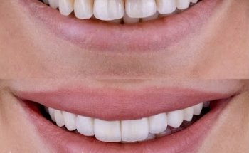 Al Andalus Dental Clinic - عيادة الأندلس لطب الأسنان