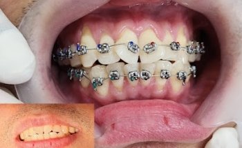 Altamayoz Dental Center Rak