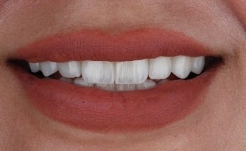 Dr. Bashar Kazaz | دكتور بشار قزاز