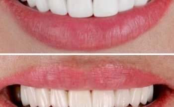 Whitey Smile Orthodontics and Implants Dental Center - Ras Al-Khaimah