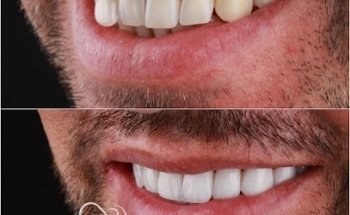 Royal Smile Dental Clinic - عيادة رويال سمايل لطب الاسنان