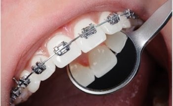 Sharjah Orthodontist -Dentist
