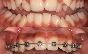 Dr Karan Kalra- Orthodontist in Dubai (braces Specialist)