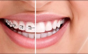 Amrita Medical Center.Dr.Fadi Ata Lahoud. .تقويم الاسنان .مركز عمريتا الطبي.د.فادي عطا لحود Orthodontist-Стоматолог-Ортодонт