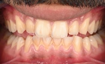 DR. FERAS CHAKHACHIRO