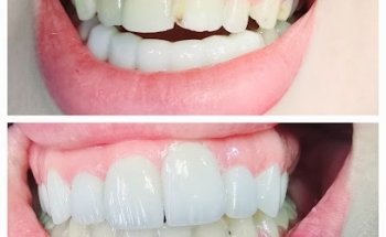 Al awael Dental Centre - مركز الأوائل لطب الأسنان