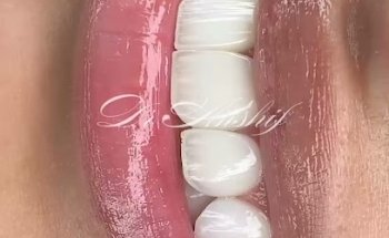 Al Arabi Dental Surgery & Implant Center, مركز العربي لجراحة وزراعة الأسنان