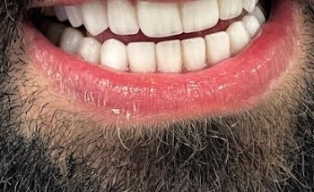 Dr Nour Nasser - Cosmetic Dentist