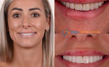 Value Dental Centres Brisbane