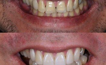 Boon Dental - Dentist Wentworth Point