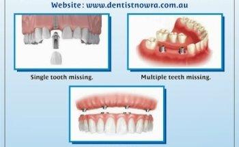 Shoalhaven Dental Surgery and Implant Centre