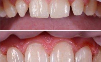 Brookwater Dental Surgery