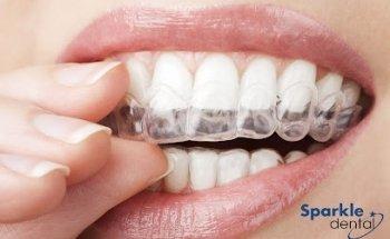 Sparkle Dental