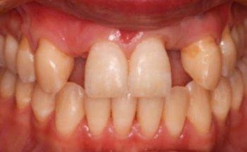 ProSmiles Dentist Collingwood