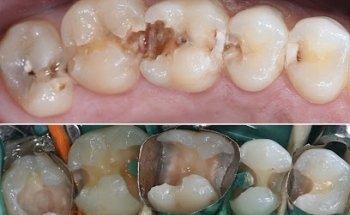 HealthPoint Dental liverpool