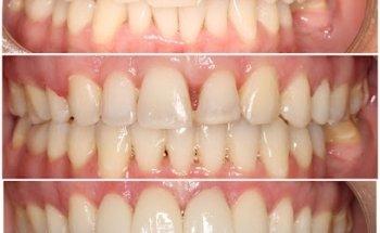 Braces N Faces Orthodontics