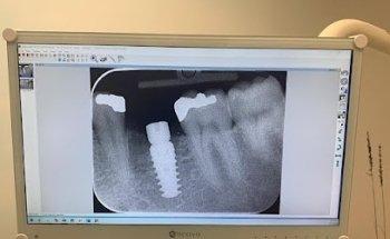 Instant Cosmetic & Implant Dental Surgery