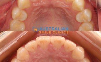 Australian Smile Clinics