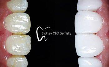 Sydney CBD Dentistry | Cosmetique Dental