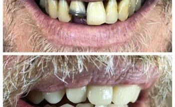 All Smiles Denture Clinic