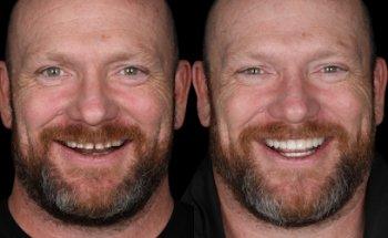 Bond Street Dental South Yarra