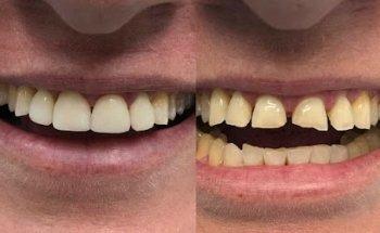 Gentle Dental Bateau Bay