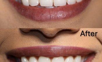 Royal Crown Family Dental