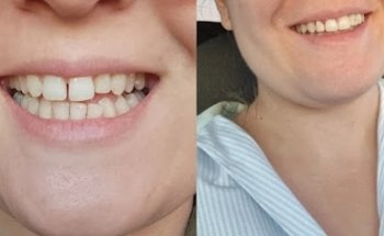 Clínica dental Caredent