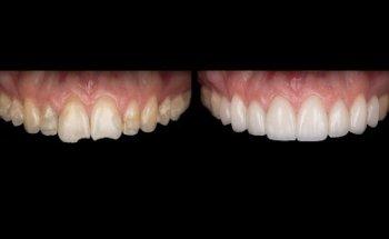 Clear Dental Toronto (Pearlwhite Dental)