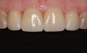 Picnic Point Dental - Panania Dentist