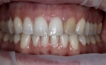 Clínica Dental Antonio Vidal