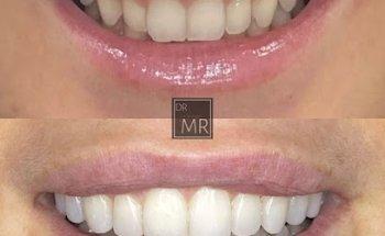 Todays Dental Edgecliff - Dr. Mathew Ramzy | Sydney Boutique Dental Studio