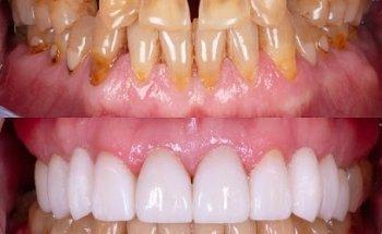 Gold Coast Dental Studio