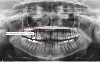 Roxburgh Park Dental Clinic - Dr Bassam Attar