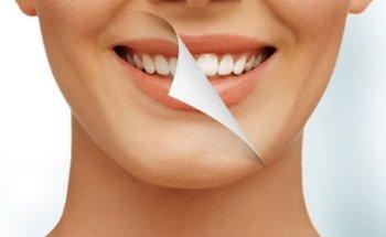 Radiant Smiles Dental Care Dental Implants Perth