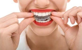 Available Dental Care - Dentist Campbelltown