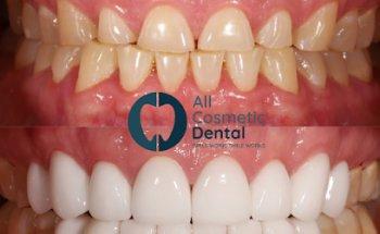 All Cosmetic Dental