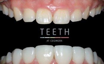 Teeth at Coomera (formerly known as Smile Fit)