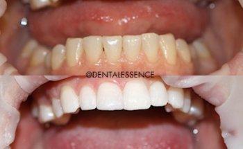 Dental Essence