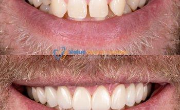 Value Dental Centres Melbourne