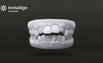 Class 1 Orthodontics