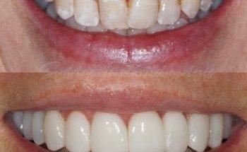 Lumiere Dental and Implants Centre